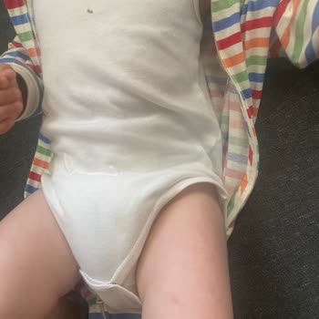 Prima Çocuk Bezi Sızdırma Yaptı