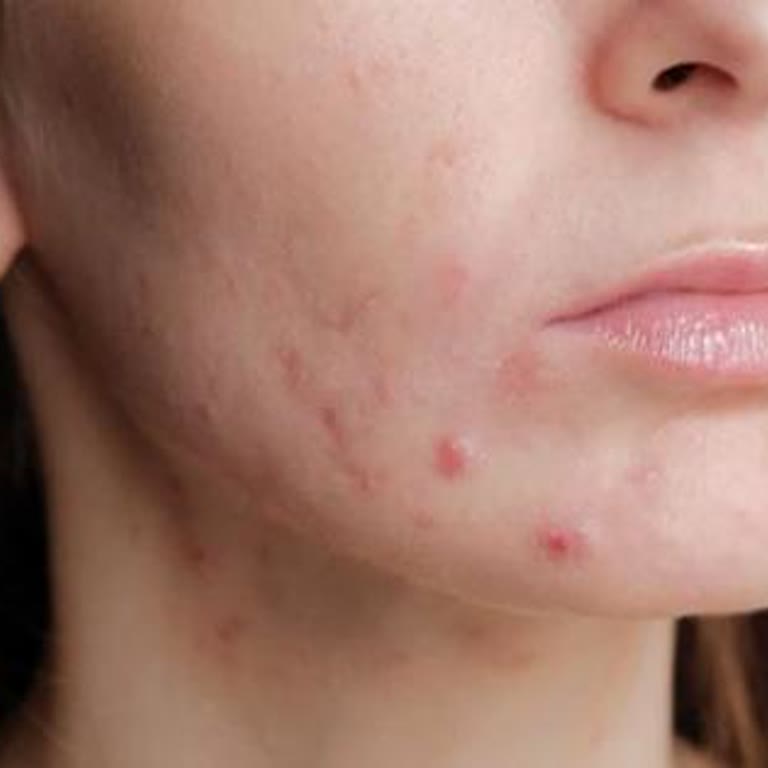 Dr. Tevhide Bozkaya Tam Bir Fiyasko