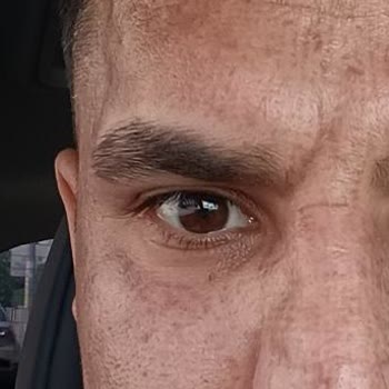 Dilan Cömertler Plazma Pen Pişmanlığı