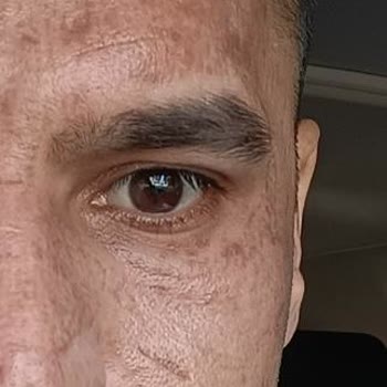 Dilan Cömertler Plazma Pen Pişmanlığı