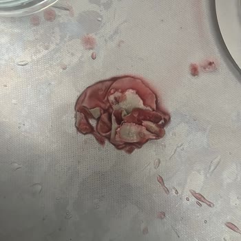 Dimes Meyve Suyu İçinden Çıkanlar İnanılmaz Ekte Mevcut Foto Ve Video