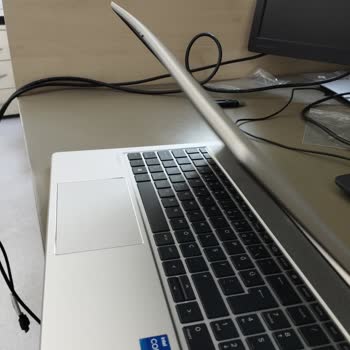 HP Kullanıcı Hatası Olmayan Soruna Kullanıcı Hatası Diyor.