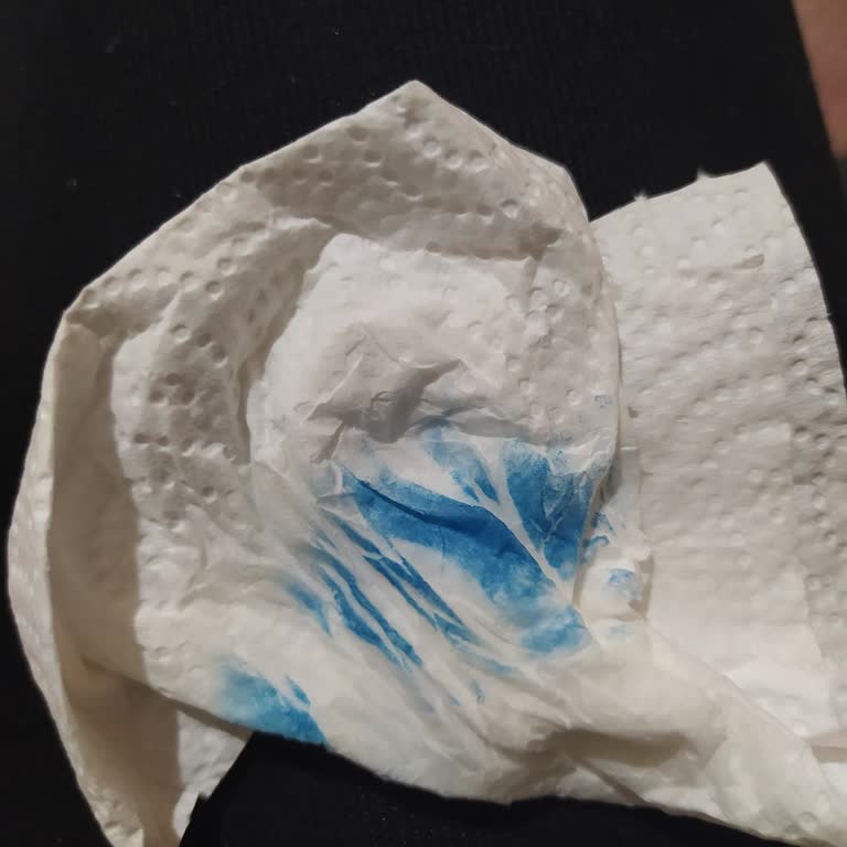 OiOi Emzik Askısı Ve Kase Şikayeti