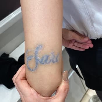 Medica Derma Dövme Silme