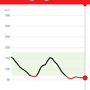 Freestyle Libre Libre2 Yanlış Ölçüm Ve Alarmlar