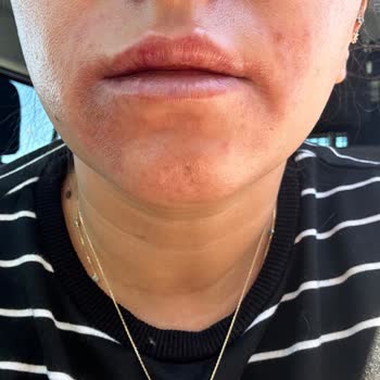 Aris Ezgi Doğan Polikliniği Estetik Uygulamalarında Yaşanan Hayal Kırıklığı