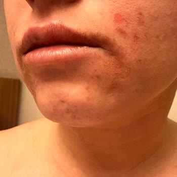 Aris Ezgi Doğan Polikliniği Estetik Uygulamalarında Yaşanan Hayal Kırıklığı