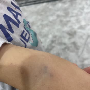 Termessos Hastanesi Çocuğum Boşuna Ağladığı İle Kaldı