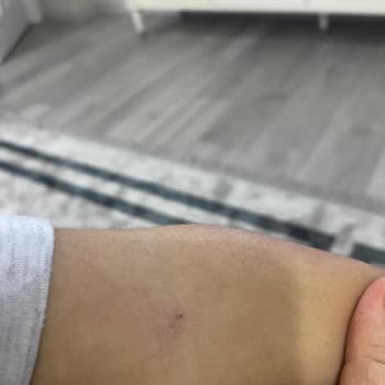 Termessos Hastanesi Çocuğum Boşuna Ağladığı İle Kaldı