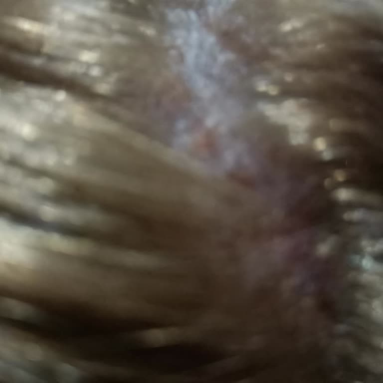 Palette Saç Boyası Kafa Derimi Yara Etti