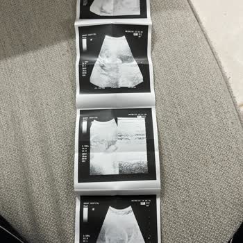 Özel Bahat Hastanesi (Sultangazi) Kadın Doğum Saygısızlığı