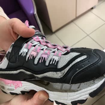 Skechers Ürün Kalitesinin Ve Müşteri Memnuniyetinin Çok Kötü Olması