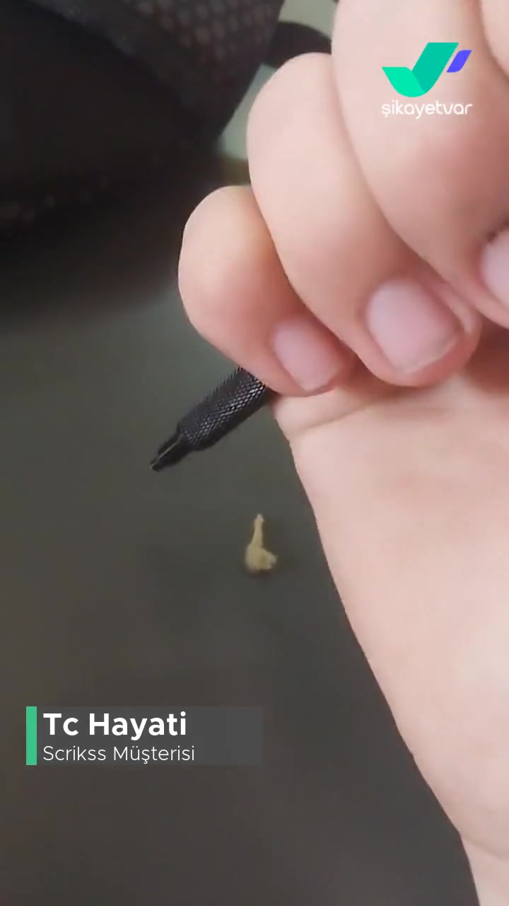 Scrikss Kalemim Bozuldu! videonun kapak resmi