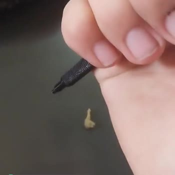 Scrikss Kalemim Bozuldu!