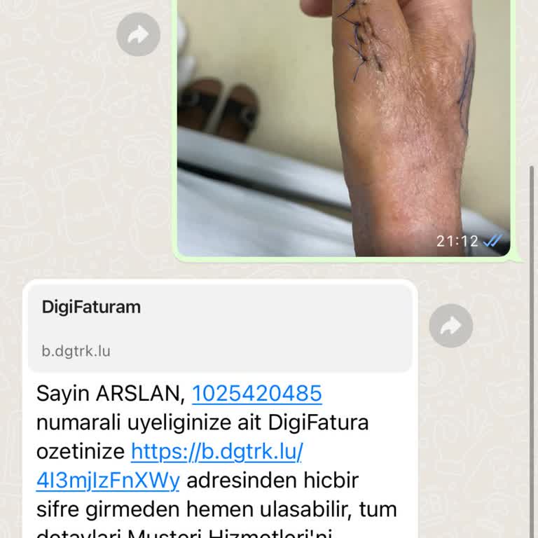 Digiturk Paket Yalanı Faturaya Yansıdı
