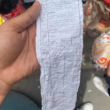 Burger King Üründen Saç Çıktı