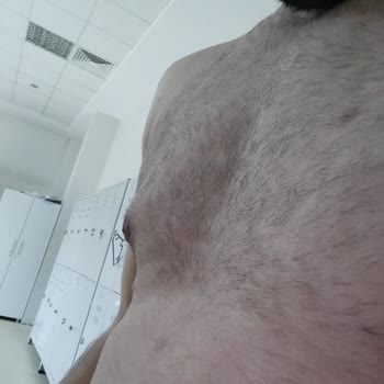 Dr. Bilgehan Aydın Jinekomasti Ameliyatından Sonra Problemler İlgisiz