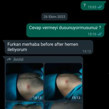 Dr. Bilgehan Aydın Jinekomasti Ameliyatından Sonra Problemler İlgisiz