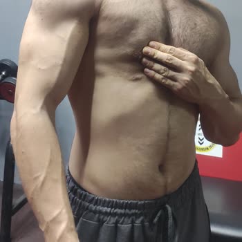 Dr. Bilgehan Aydın Jinekomasti Ameliyatından Sonra Problemler İlgisiz