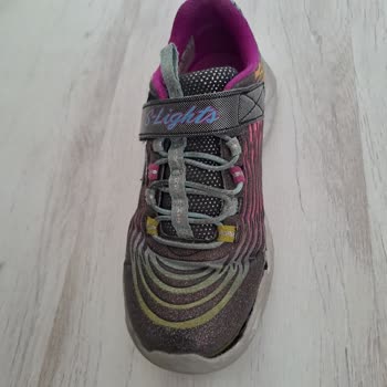 Skechers Sneakers Ayakkabı Açılma Problemi
