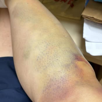 Elexus Hotel Elexus Otel-kıbrıs- Oda Ve Banyo Özensizliği