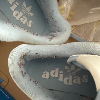 Adidas Ayakkabı Tüylenme Oldu