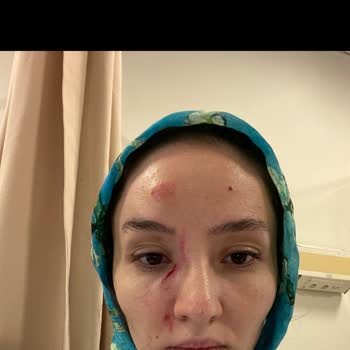 Manici Kasrı Otel'de Yaşadığımız Hayati Tehlike