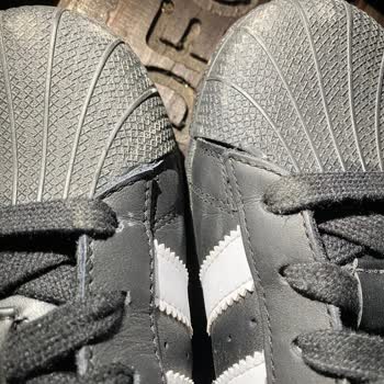 N11 Ve Koray Spor Adidas Superstar Mağduriyetim