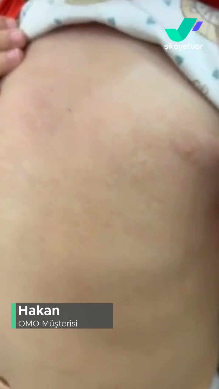 OMO Alerji Yaptı! videonun kapak resmi