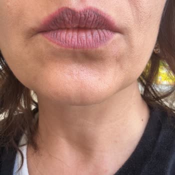 Yk Mas Akademi Yanlış Yapılan İşlem!