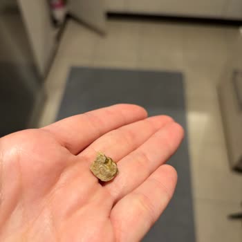 Glutensiz Fabrika İnsan Sağlığı İle Oynuyor