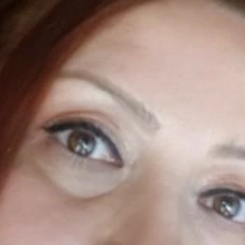 Op. Dr. Ali Cemal Yılmaz  Göz Kapağı Estetiği Mağduru!