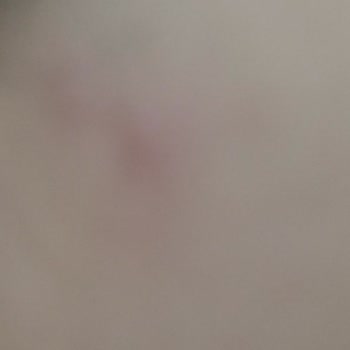 Gratis Beaulis Tarihi Geçmiş Ürün Cildime Verdiği Zarar Şikayet