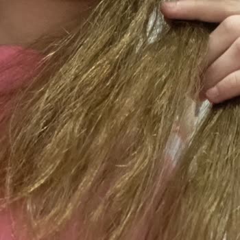 Ömer Açık Kuaför Saçımı Yaktı