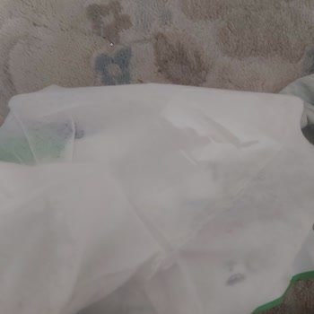 Sleepy Islak Mendilin İçinden Çıkan Yabancı Cisimler