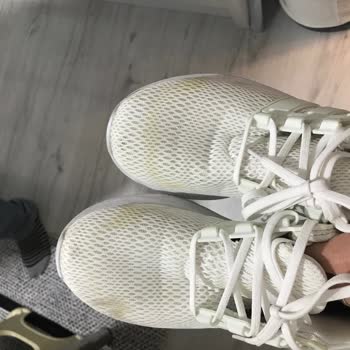 Adidas-Schuhe Verfärbung während der Garantiezeit, aber unzureichende Rückerstattung