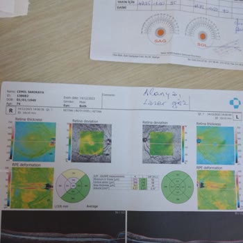 Lazer Göz Tıp Merkezi Alanya Lazer Göz
