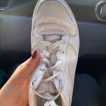 Skechers Ayakkabımın Önünün Bükülmesi Ve Yanlarının Açılması