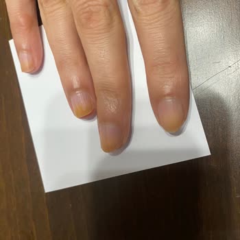 Flormar Oje Tırnaklarda Turuncu İzler Yaptı