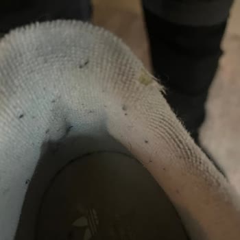 Forum İstanbul AVM Adidas Ayakkabı Deformasyon Hatası