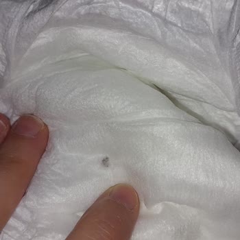 Sleepy Bezde Farklı Bir Cisim Çıktı