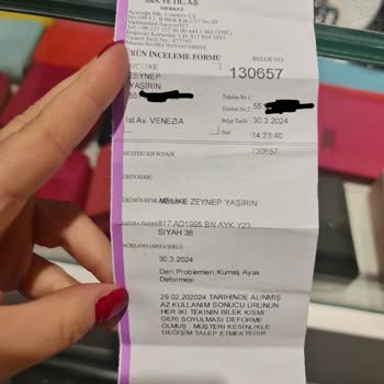 Tamer Tanca Ayakkabı Deri Soyulması