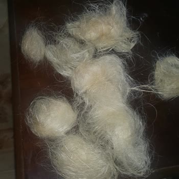 Saç Kaynak Merkezi  Yanıltmacası!