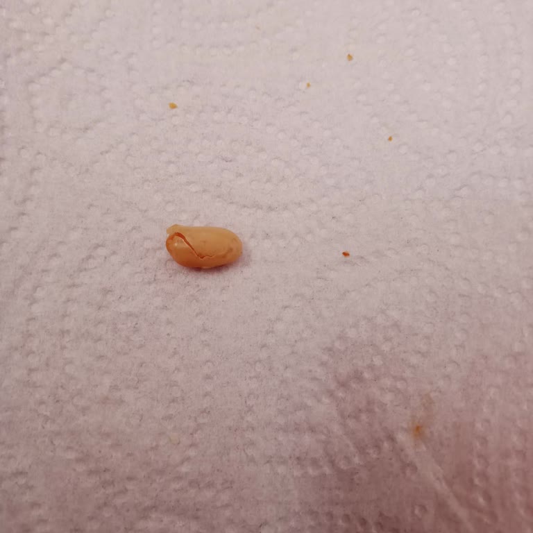 A101 Market Zincirinde Satılan Gevrekte Sert Cisim Şikayeti