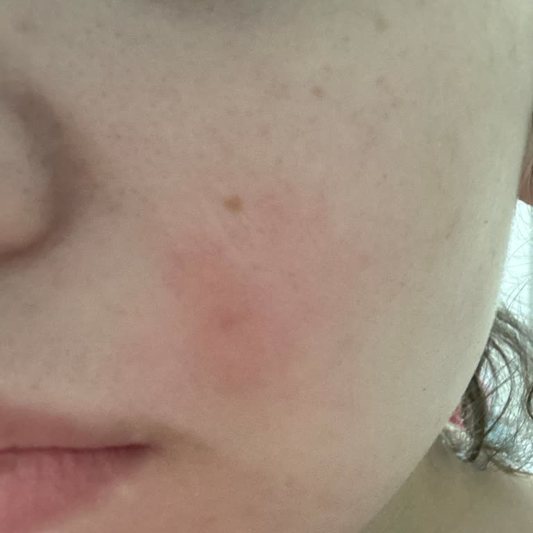 The Purest Solutions The Purest Tonik Faciası