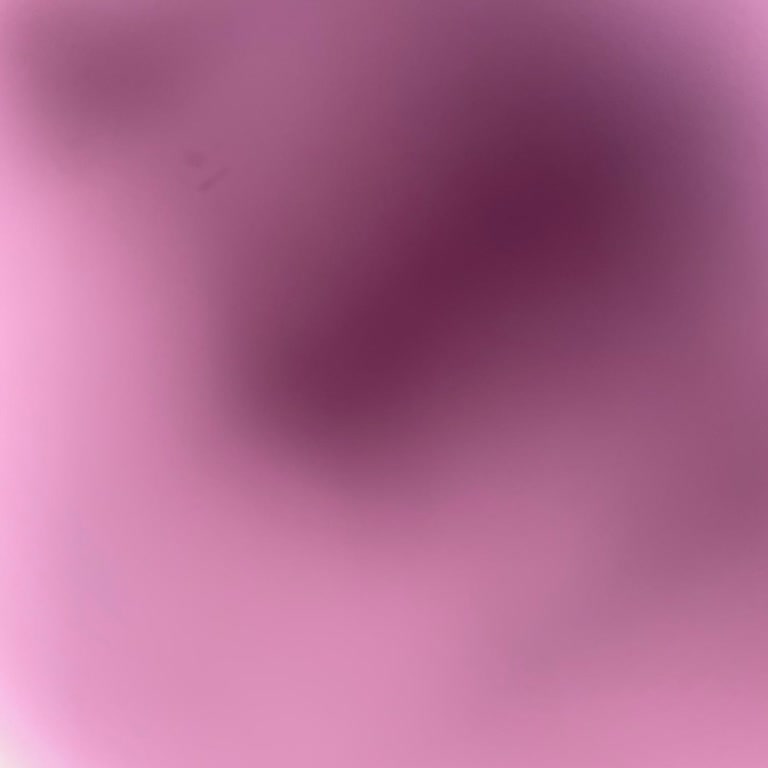 Obilet Para İadem Yapılmadı