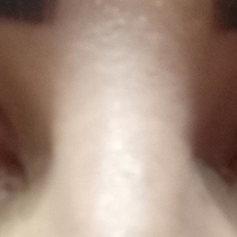 Otacı Göz Bakım Serumu Kullanımı Sonrası Yaşanan Olumsuz Tepkiler