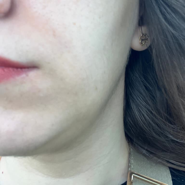 Novar Poliklinik Hizmetten Duyulan Memnuniyetsizlik Ve Fiyat Artışı