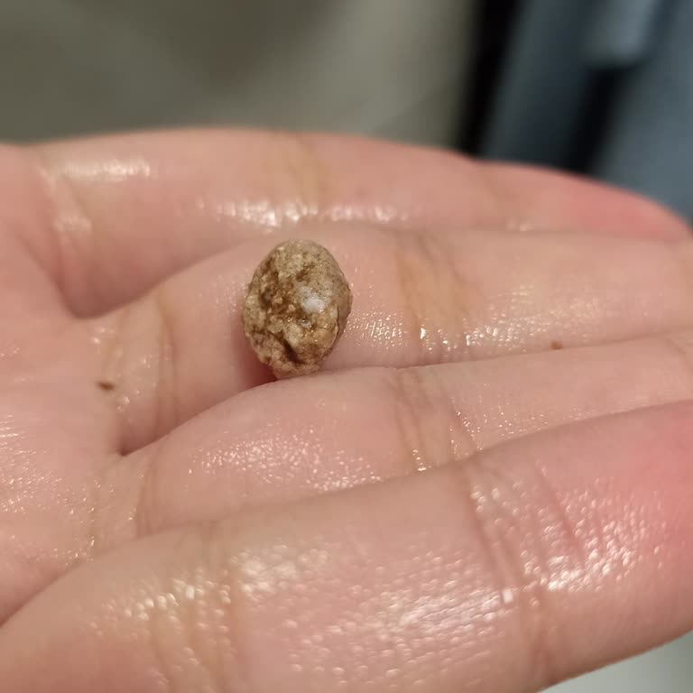 Yuvam Barbunya Pilaki İçinden Taş Çıktı