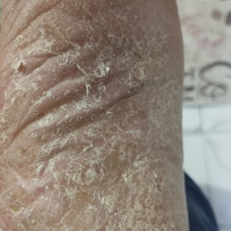 Özel Çapa Hastanesi Ayaklarım Ağrıyor İyileşmek İstiyorum